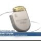 Health Headlines: New implantable device helping heart patients